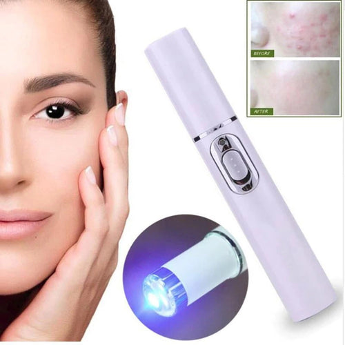 Lovilds® Non-Invasive Mole and Wart Removal Laser Pen(⏰Limited Time Discount⏰)