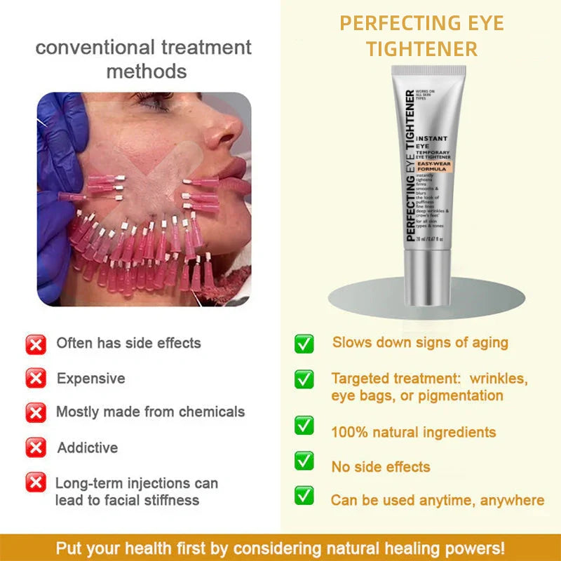🌸 PERFECTING EYE TIGHTENER – New Formula, Ultimate Lift & Smooth Finish ✨
