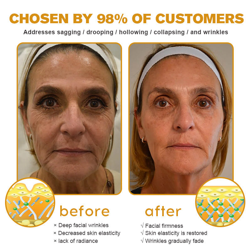 🌸 PERFECTING EYE TIGHTENER – New Formula, Ultimate Lift & Smooth Finish ✨