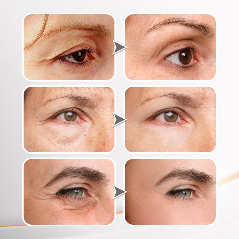 LAST DAY SALE-80% OFF🔥Lift & Firm Instant  Face Tightener
