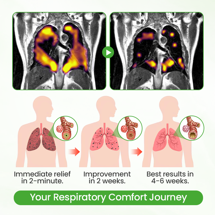 BBOJI® HerbaAir Mullein Lung Purifier