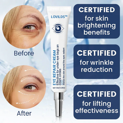 Lovilds™ YouthfulLift Timely Anti-Wrinkle Firming Eye Cream（🔥LAST DAY SALE-80% OFF)