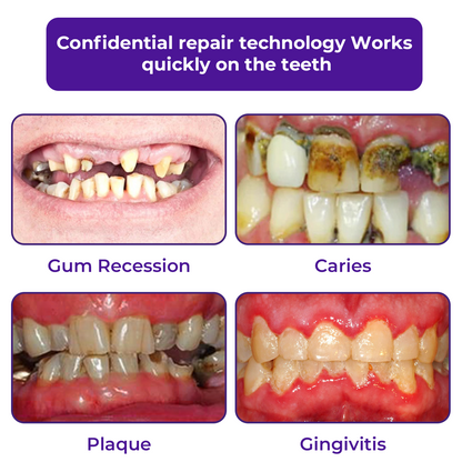 🦷LOVILDS™ Dental Repair Mineral Powder >> 🔥Buy 1 Get 1 Free🔥