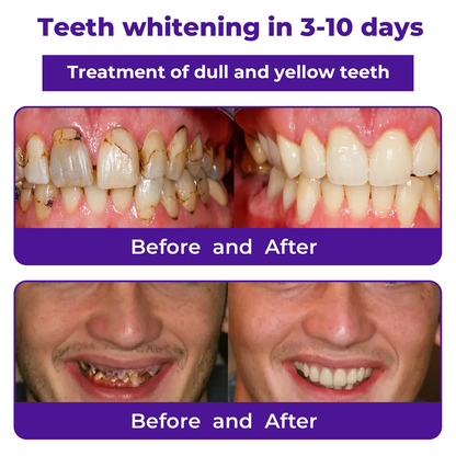 🦷LOVILDS™ Dental Repair Mineral Powder >> 🔥Buy 1 Get 1 Free🔥