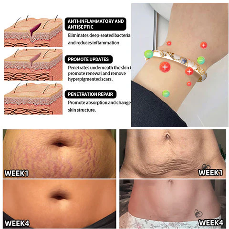 𝑪𝒍𝒐𝒊𝒔𝒐𝒏𝒏é 𝑬𝒏𝒂𝒎𝒆𝒍 👩‍⚕️𝑳𝒚𝒎𝒑𝒉𝒂𝒕𝒊𝒄 𝑴𝒂𝒈𝒏𝒆𝒕𝒊𝒄 𝑻𝒉𝒆𝒓𝒂𝒑𝒚 𝑮𝒐𝒍𝒅 𝑩𝒓𝒂𝒄𝒆𝒍𝒆𝒕🔥🔥🔥